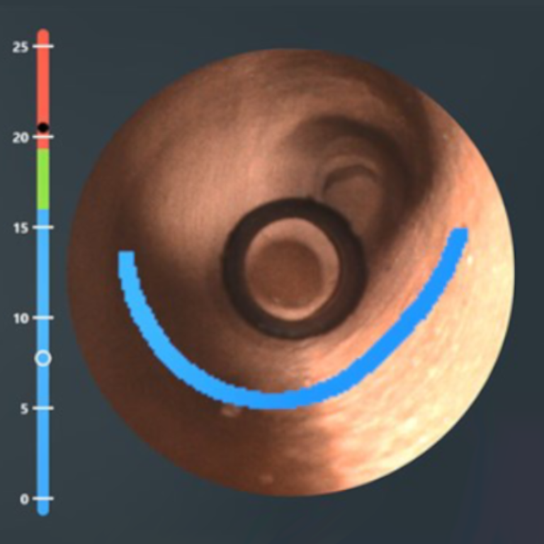 Live Kamera des 3D Ohr Scanners